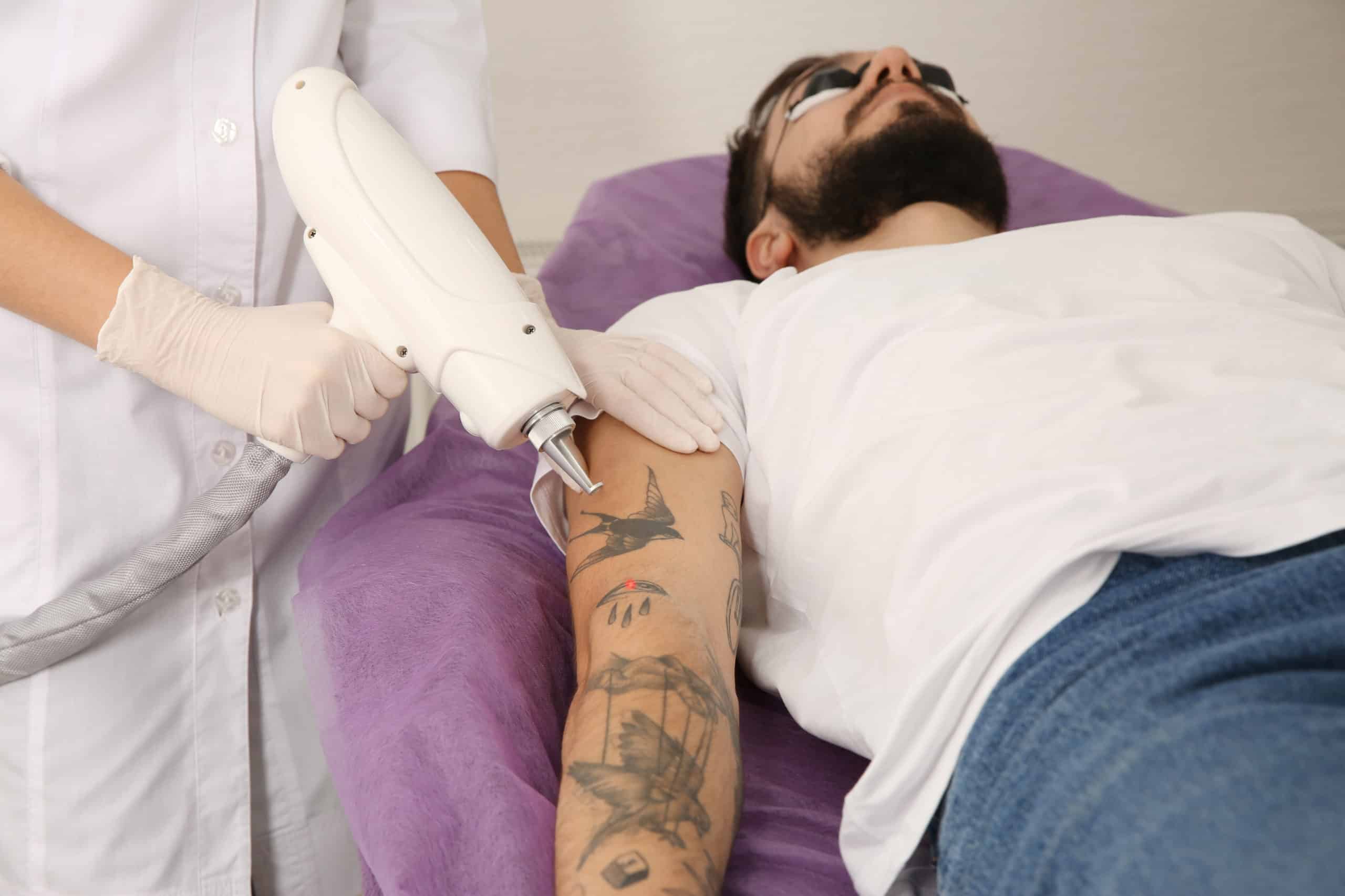 Laser Tattoo Removal in Cedar Rapids, IA | Cosmetic Solutions